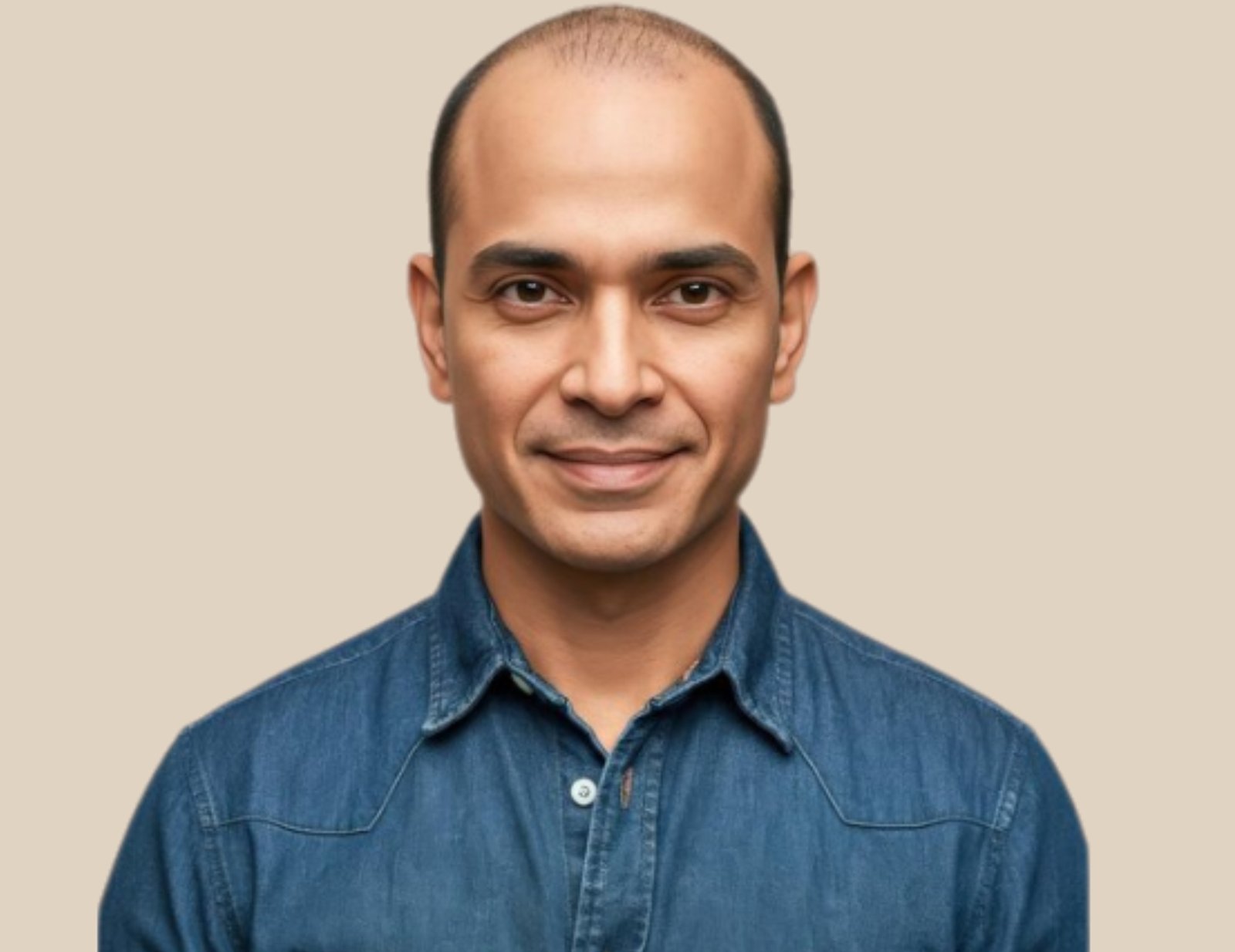 beard transplant cost