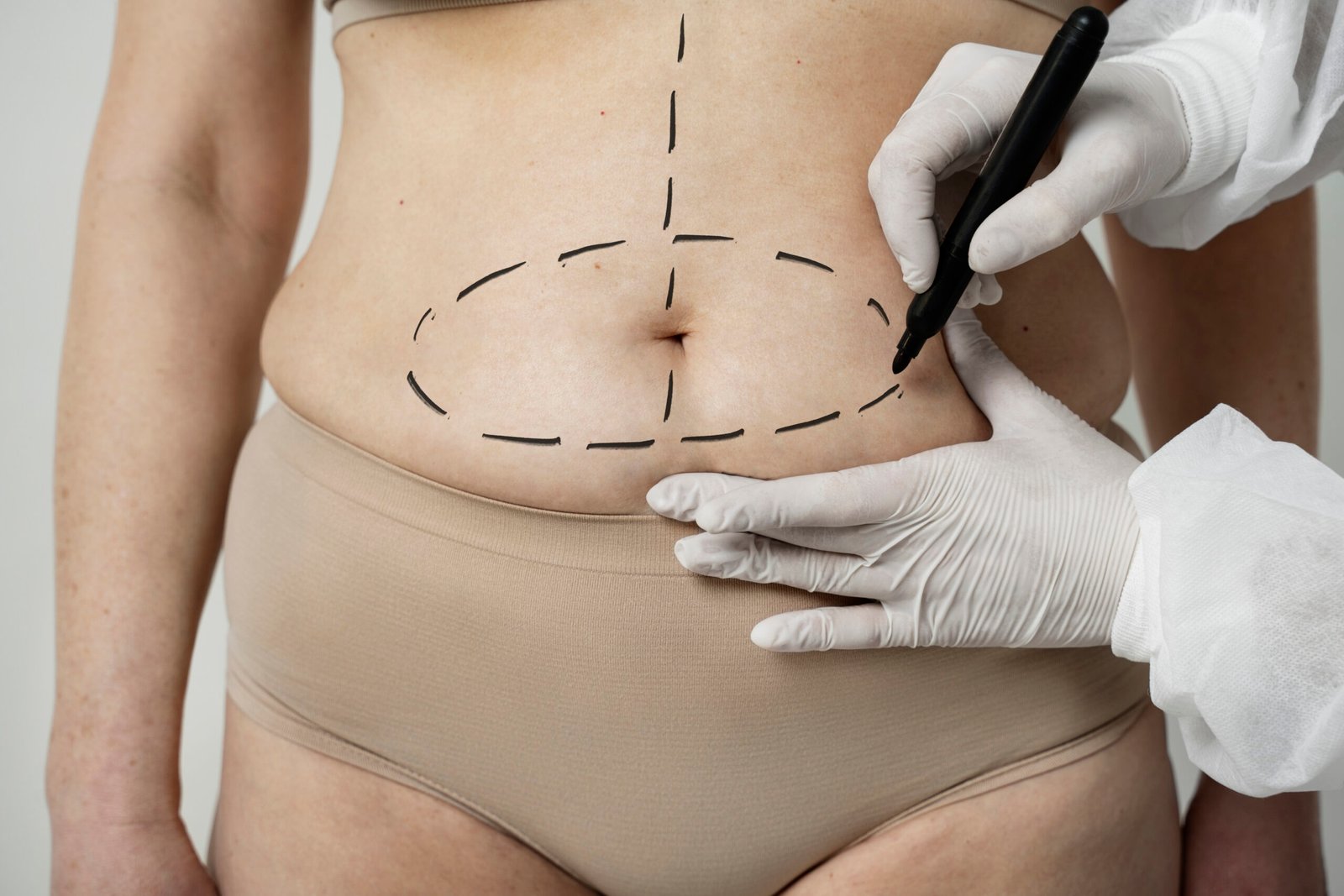 tummy tuck surgery cost