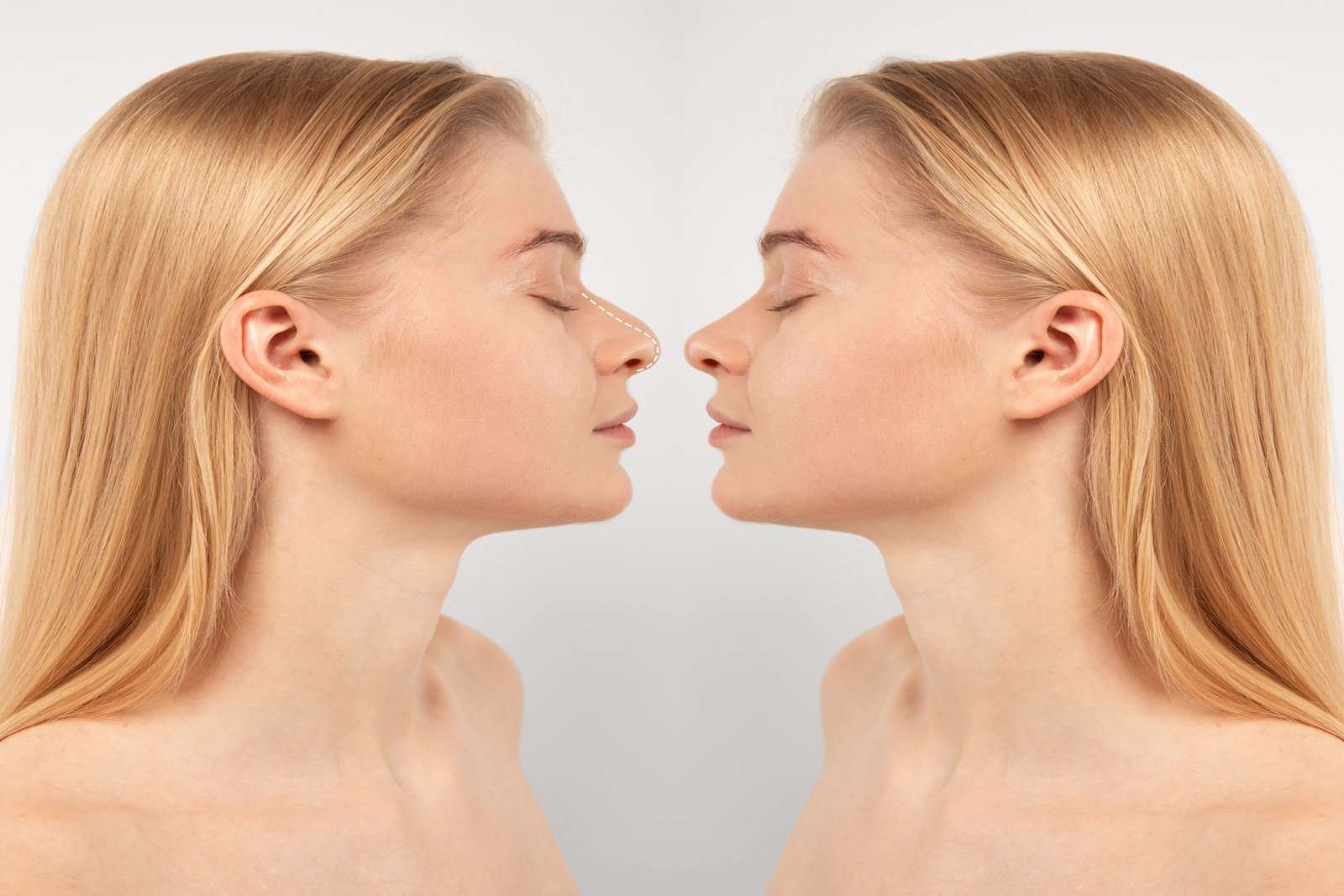 rhinoplasty-surgery-concept-with-woman-model.jpeg